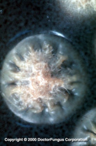 Yeast Phase of Histoplasma capsulatum var duboisii, GMS stain