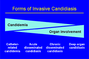 The four forms of invasive candidiasis