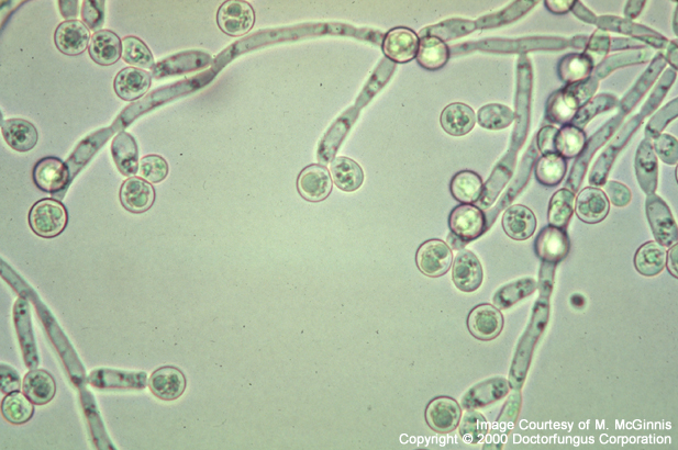 Candida Albicans Microscopic Morphology