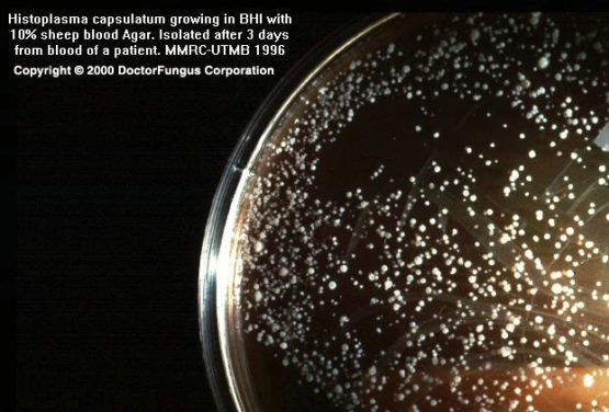 Histoplasma Species - Doctor Fungus