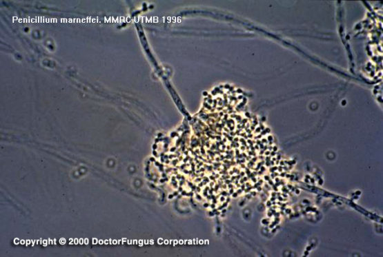 Especies De Penicillium IWOFR