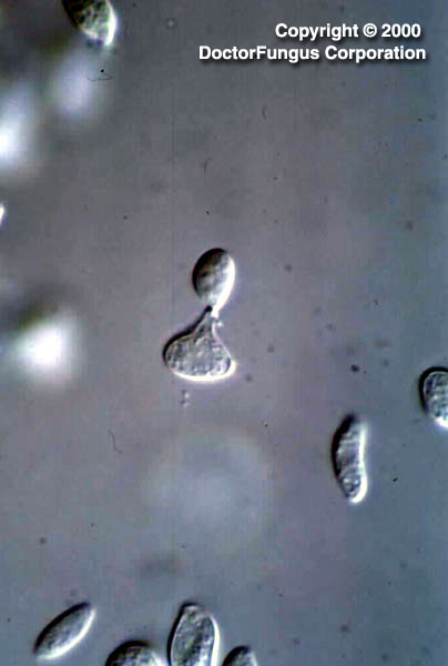 Sporobolomyces Species