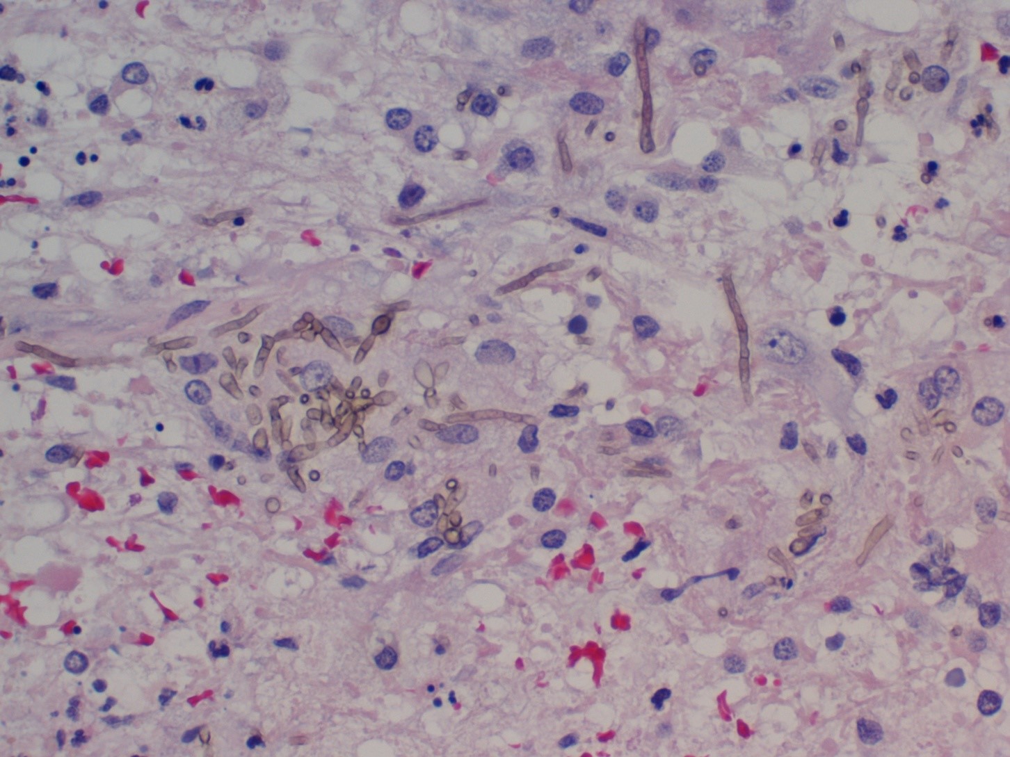 Histology 4 - Doctor Fungus