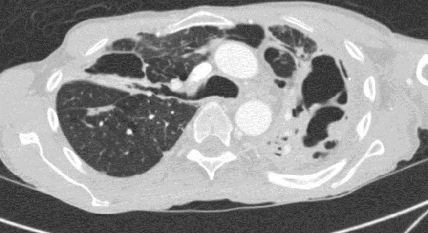 December 2020 Case Of The Month Doctor Fungus