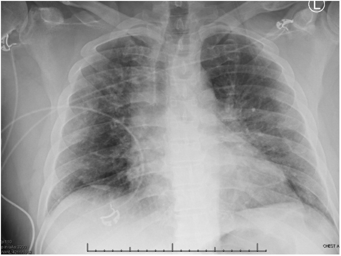 February 2022 Case of the Month - Doctor Fungus