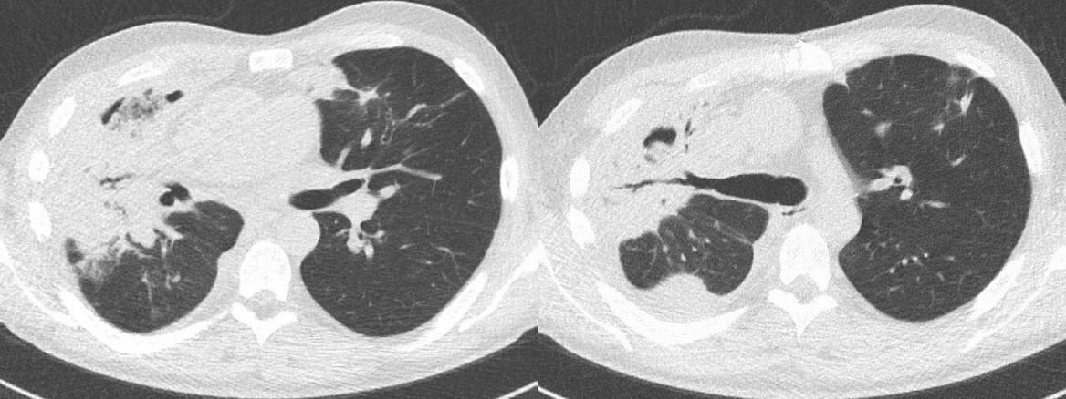 April 2023 Case Of The Month Doctor Fungus